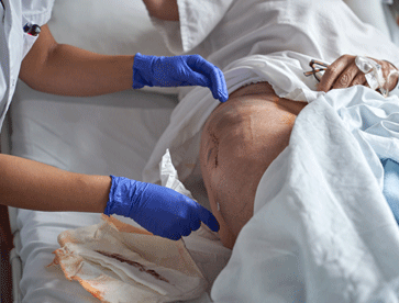 Cuidador de Pós-Cirúrgicos